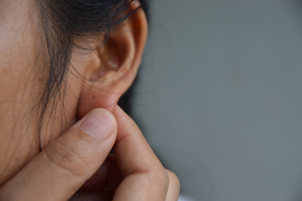 How To Repair Ear Lobe Slits & Holes